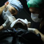 Highly Skilled Surgeons Performing a Hair Transplant with Care and Precision