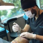 During Hair Transplant