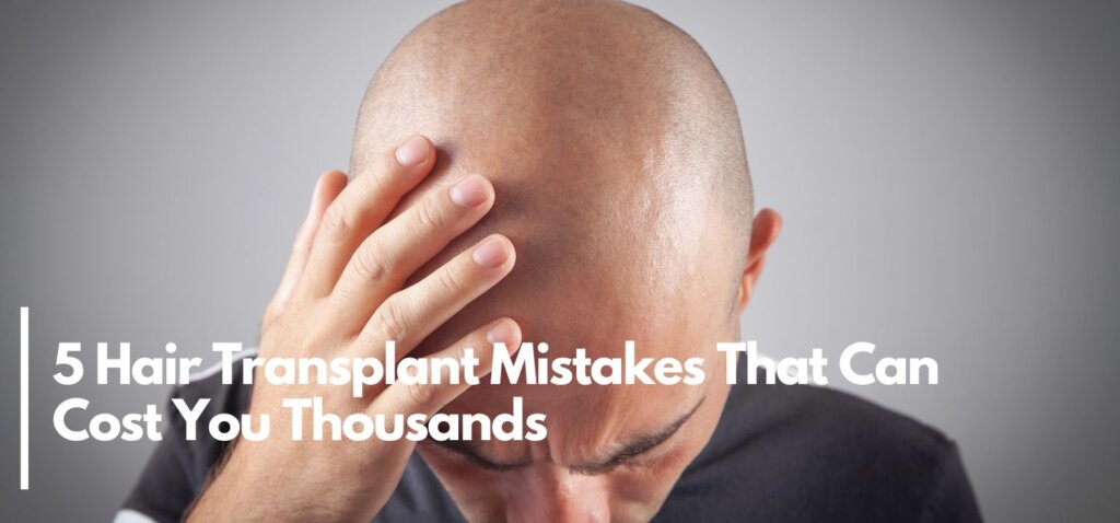 5 Hair Transplant Mistakes That Can Cost You Thousands