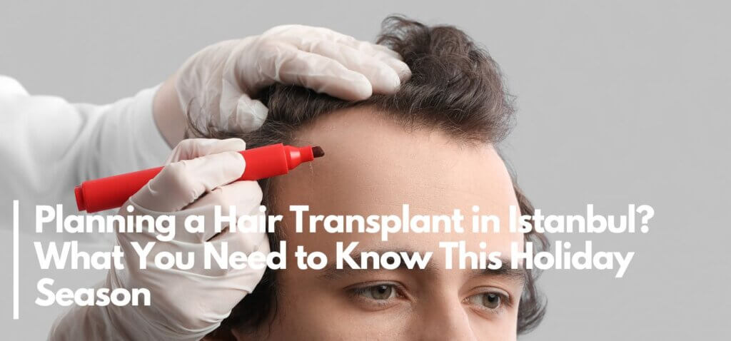 planning a hair transplant in istanbul what you need to know this holiday season